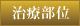 治療部位