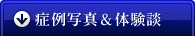症例写真＆体験談