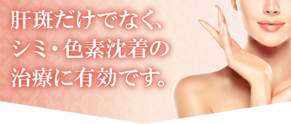 肝斑だけでなく、シミ・色素沈着の治療に有効です。
