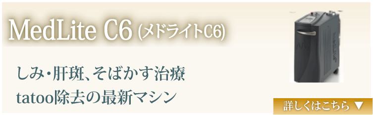MedLite C6（メドライトC6）　しみ、肝斑、そばかす治療、tattoo除去の最新マシン