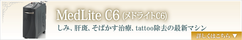 MedLite C6（メドライトC6）　しみ、肝斑、そばかす治療、tattoo除去の最新マシン